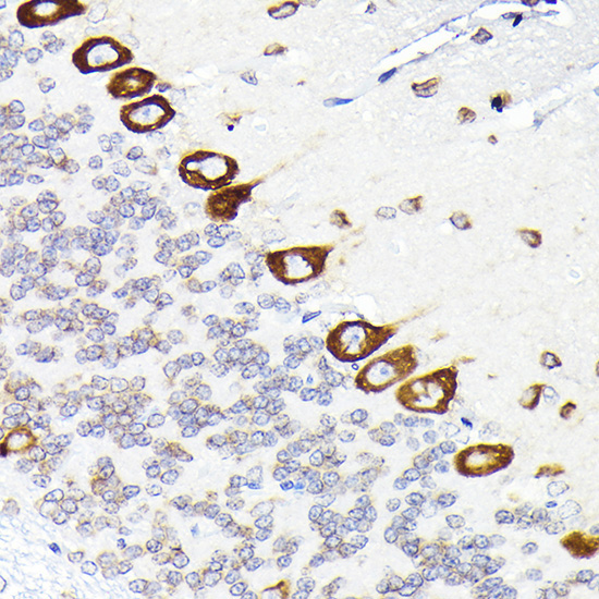 eEF1G Rabbit Polyclonal Antibody - Image 2