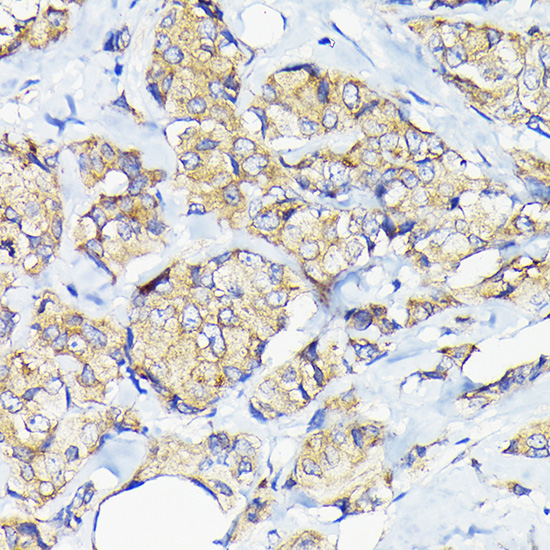 eEF1G Rabbit Polyclonal Antibody - Image 3