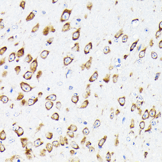 eEF1G Rabbit Polyclonal Antibody - Image 4
