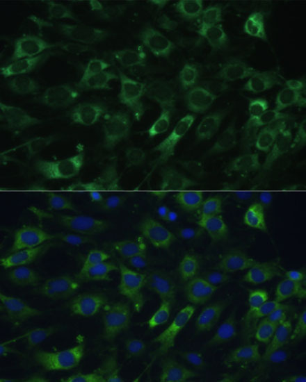 eEF1G Rabbit Polyclonal Antibody - Image 5