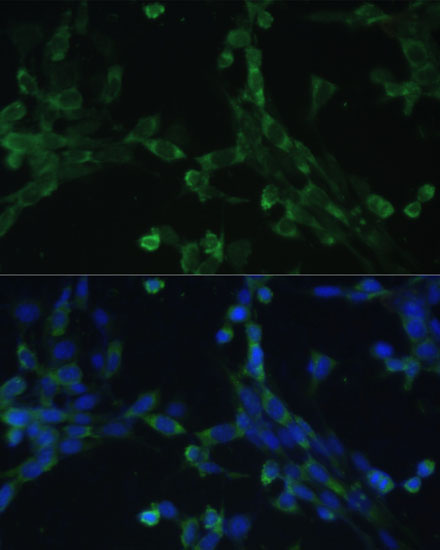 eEF1G Rabbit Polyclonal Antibody - Image 6