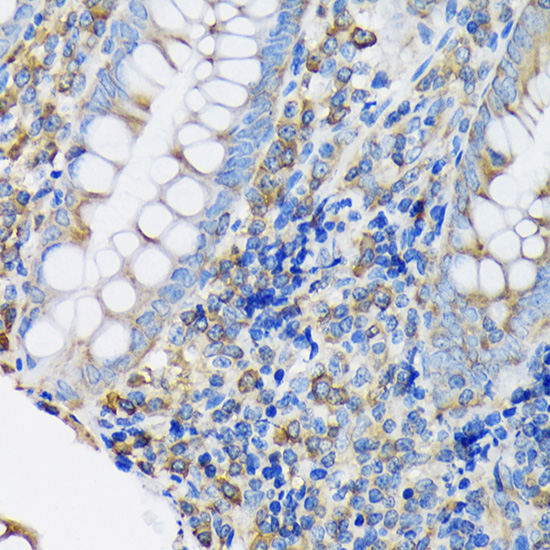 eEF2 Rabbit Monoclonal Antibody - Image 3