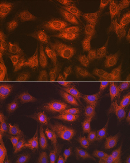 eEF2 Rabbit Monoclonal Antibody - Image 4