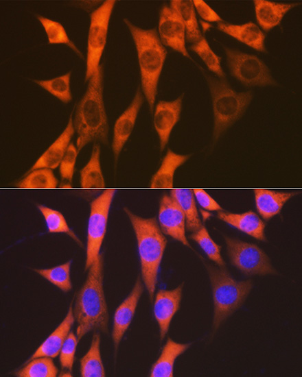 eEF2 Rabbit Monoclonal Antibody - Image 5
