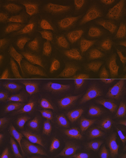 eEF2 Rabbit Monoclonal Antibody - Image 6