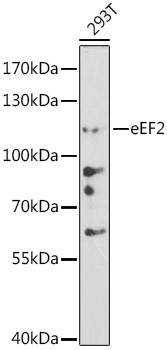 eEF2 Rabbit Polyclonal Antibody