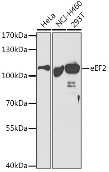 eEF2 Rabbit Polyclonal Antibody