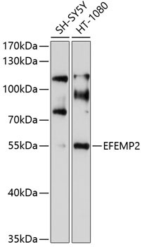 EFEMP2 Rabbit Polyclonal Antibody