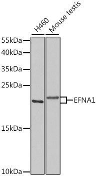 EFNA1 Rabbit Polyclonal Antibody