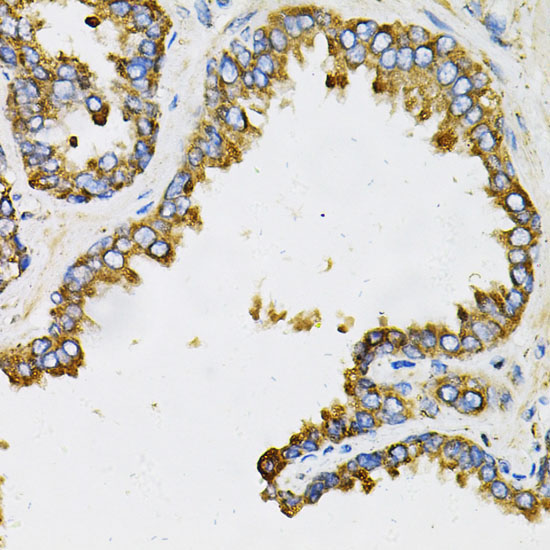 EFNA1 Rabbit Polyclonal Antibody - Image 2
