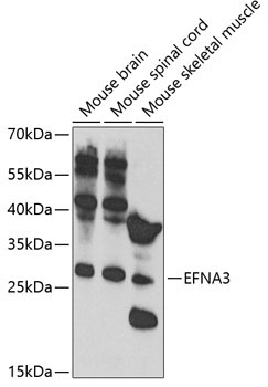 EFNA3 Rabbit Polyclonal Antibody
