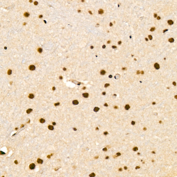 EFTUD2 Rabbit Polyclonal Antibody - Image 2