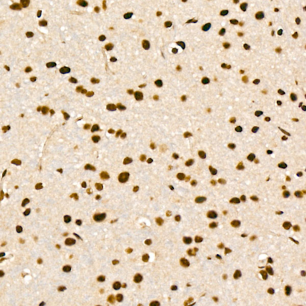 EFTUD2 Rabbit Polyclonal Antibody - Image 3