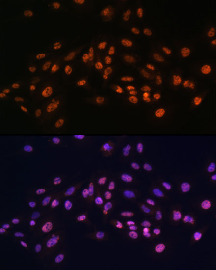 EFTUD2 Rabbit Polyclonal Antibody - Image 4