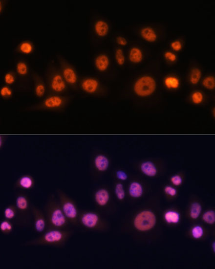 EFTUD2 Rabbit Polyclonal Antibody - Image 5