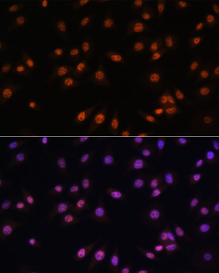 EFTUD2 Rabbit Polyclonal Antibody - Image 6