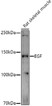 EGF Rabbit Polyclonal Antibody