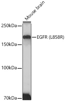 EGFR (L858R) Rabbit Monoclonal Antibody