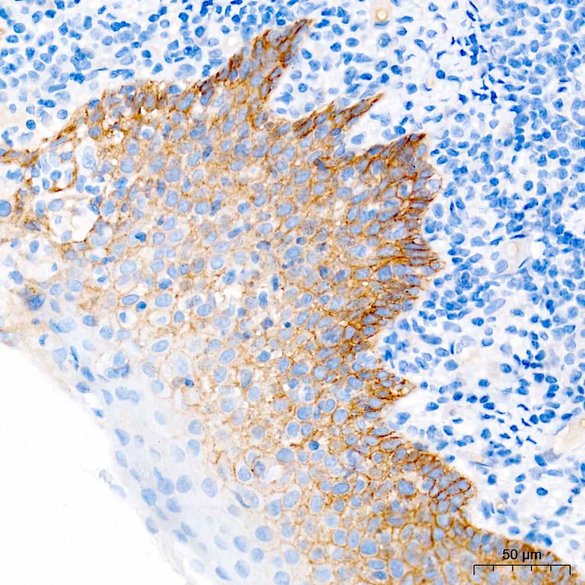 EGFR Rabbit Monoclonal Antibody - Image 3