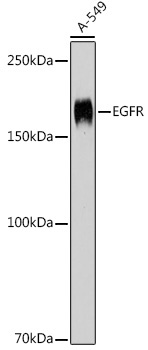 EGFR Rabbit Polyclonal Antibody