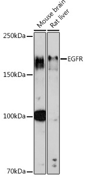 EGFR Rabbit Polyclonal Antibody - Image 2