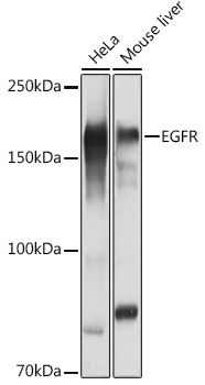 EGFR Rabbit Polyclonal Antibody - Image 3