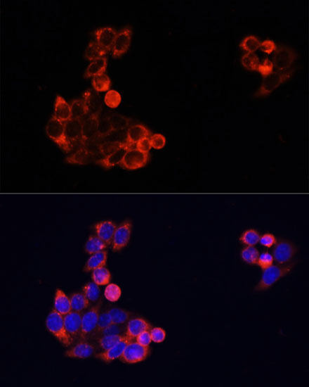 EGFR Rabbit Polyclonal Antibody - Image 4