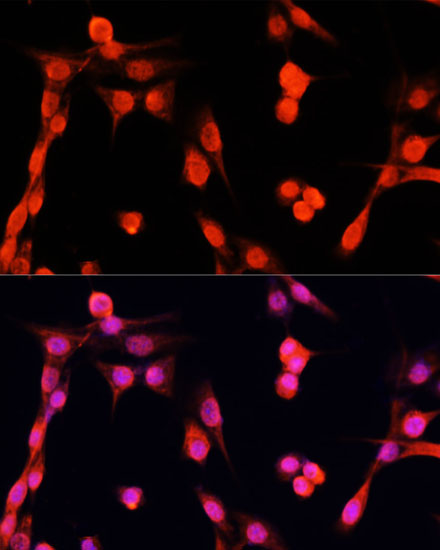 EGFR Rabbit Polyclonal Antibody - Image 5