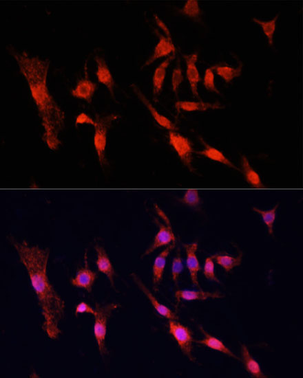 EGFR Rabbit Polyclonal Antibody - Image 6
