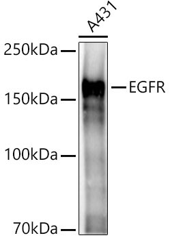 EGFR Rabbit Polyclonal Antibody