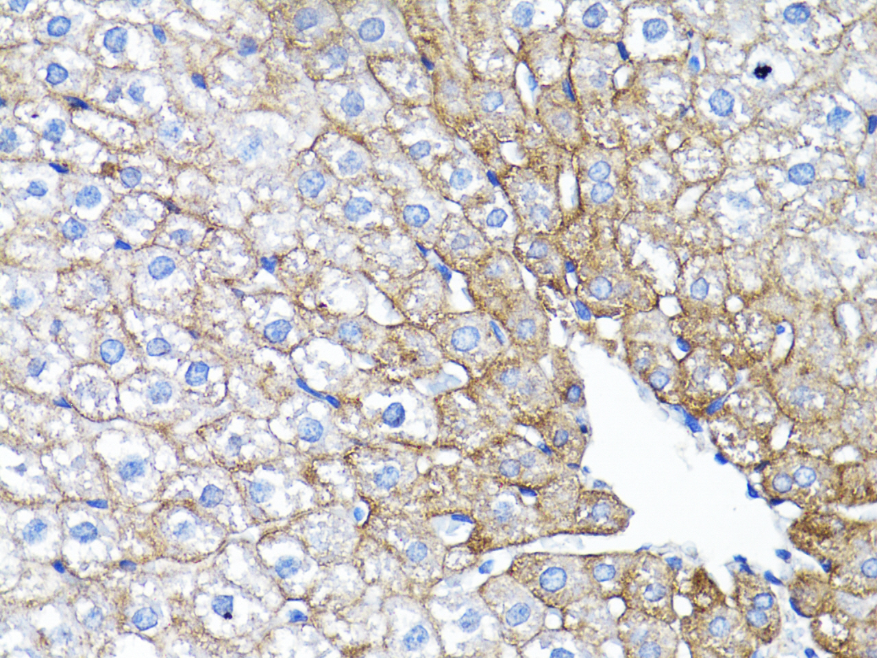 EGFR Rabbit Polyclonal Antibody - Image 2