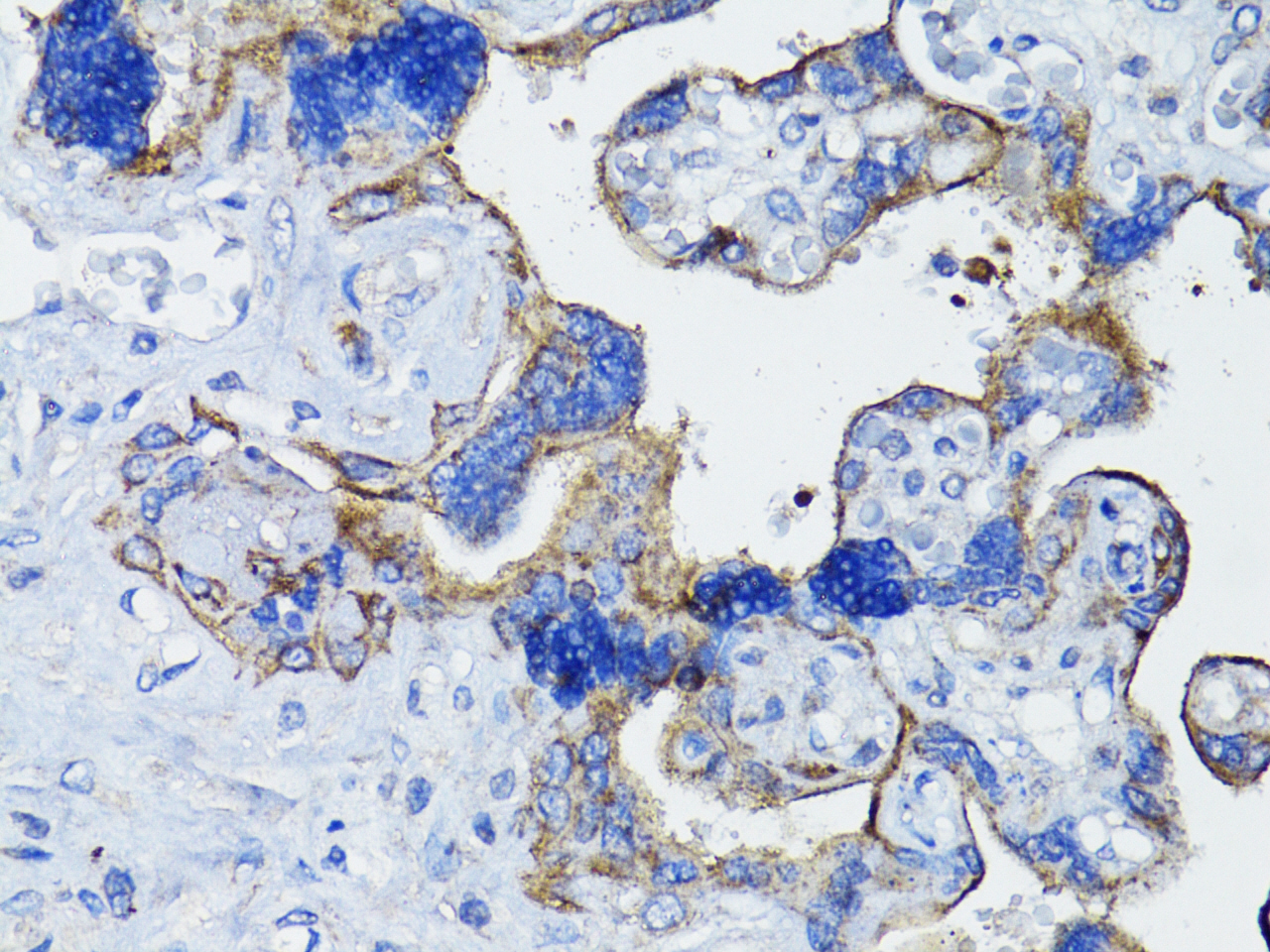 EGFR Rabbit Polyclonal Antibody - Image 3