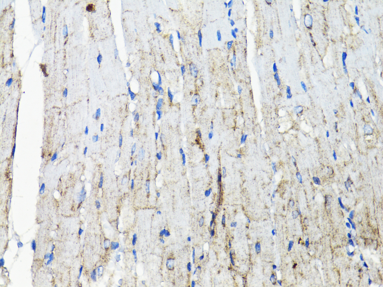 EGFR Rabbit Polyclonal Antibody - Image 4