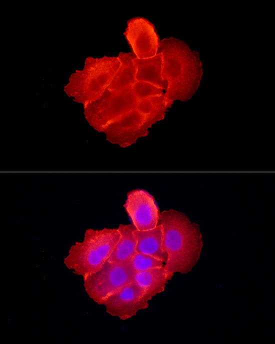 EGFR Rabbit Polyclonal Antibody - Image 5