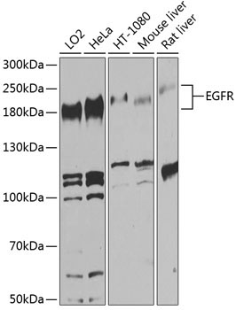 EGFR Rabbit Polyclonal Antibody