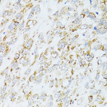 EGFR Rabbit Polyclonal Antibody - Image 2