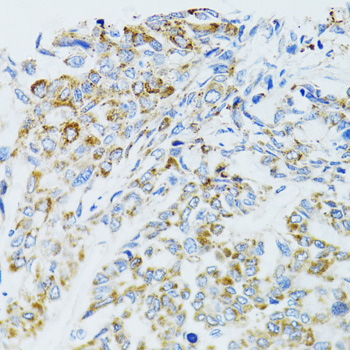 EGFR Rabbit Polyclonal Antibody - Image 3