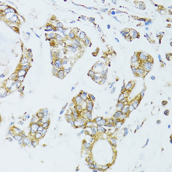 EGFR Rabbit Polyclonal Antibody - Image 4