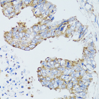 EGFR Rabbit Polyclonal Antibody - Image 5