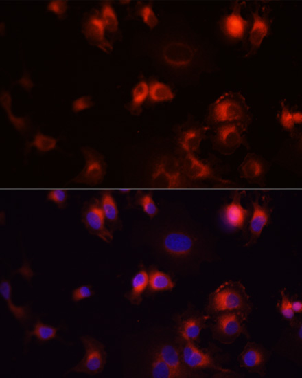 EGFR Rabbit Polyclonal Antibody - Image 6