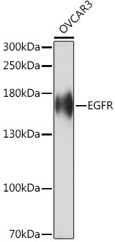 EGFR Rabbit Polyclonal Antibody