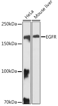 EGFR Rabbit Polyclonal Antibody
