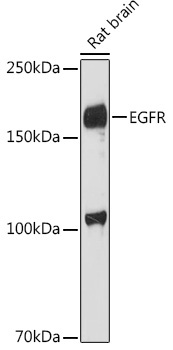 EGFR Rabbit Polyclonal Antibody - Image 2