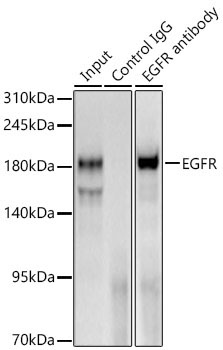 EGFR Rabbit Polyclonal Antibody - Image 3