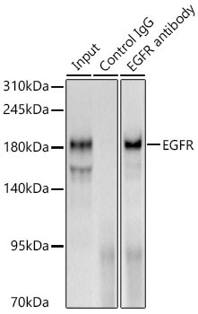 EGFR Rabbit Polyclonal Antibody - Image 4