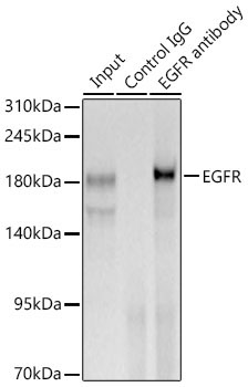 EGFR Rabbit Polyclonal Antibody - Image 5