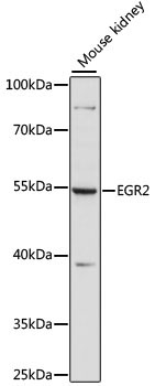 EGR2 Rabbit Polyclonal Antibody