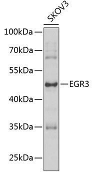 EGR3 Rabbit Polyclonal Antibody