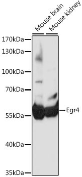 Egr4 Rabbit Polyclonal Antibody