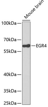 EGR4 Rabbit Polyclonal Antibody